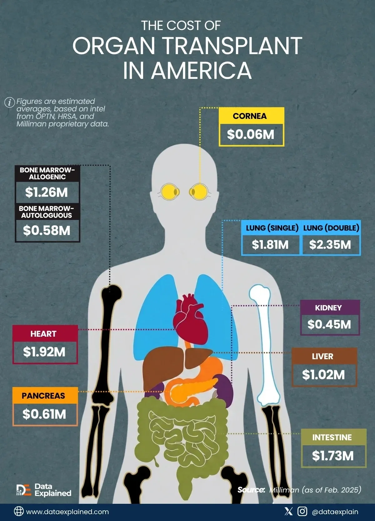 Breakdown: Price Gap Inside America’s Organ Transplant System