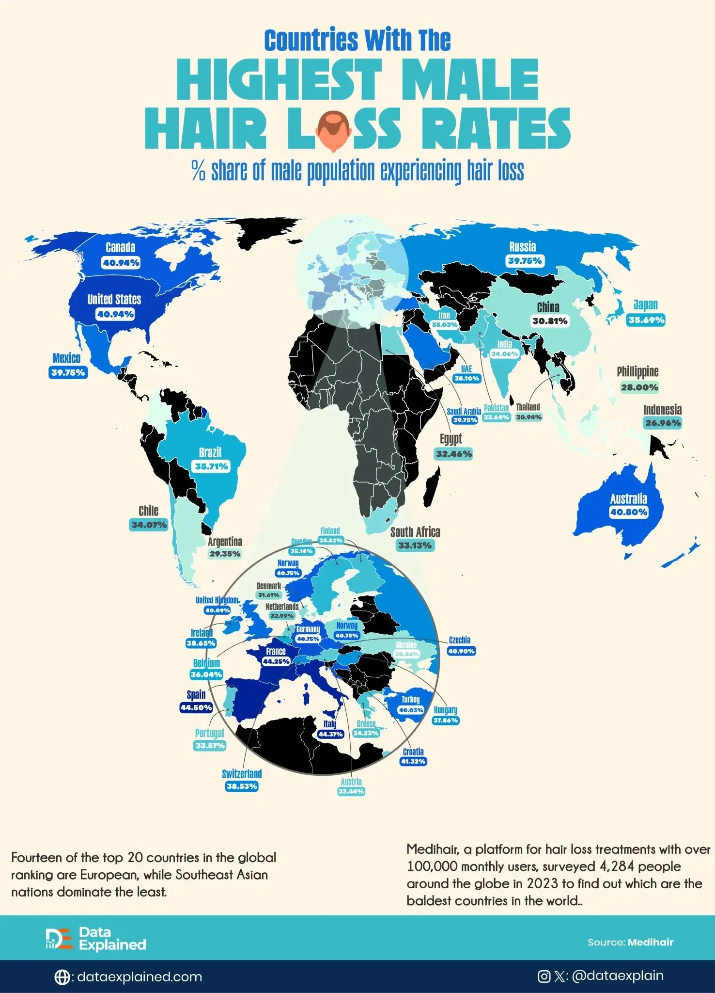 Europe Has the World’s Highest Male Hair Loss Rates