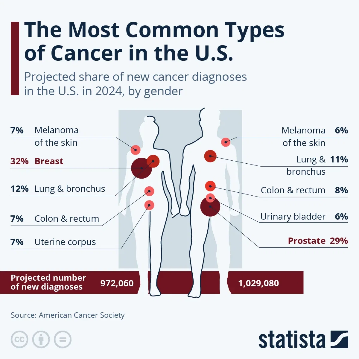 The Most Common Types of Cancer in the U.S.